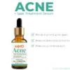 Skino Acne + Spot Treatment Serum